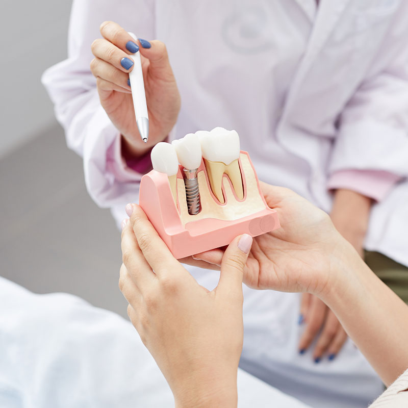 An image of a dental professional holding a model of a human mouth with teeth and gums, demonstrating the process of dental implantation or examination to an attentive patient.