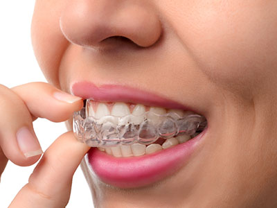 An adult female with a clear complexion is seen holding and examining her teeth, which are fitted with a set of white, transparent braces.