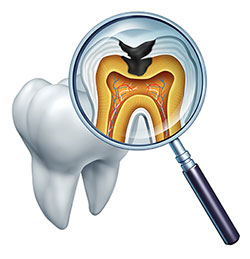 An image of a magnified tooth with a cross-section view, showing the interior structure and root, viewed through a magnifying glass, accompanied by an illustration of a toothbrush.