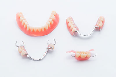 A collection of dental braces and retainers, displayed on a white background.