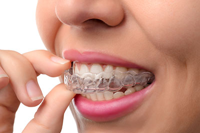 The image shows a person with braces in their mouth, holding a toothpaste tube.