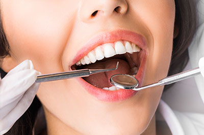 A person with a wide smile is receiving dental care, with a dentist using dental tools on their teeth.