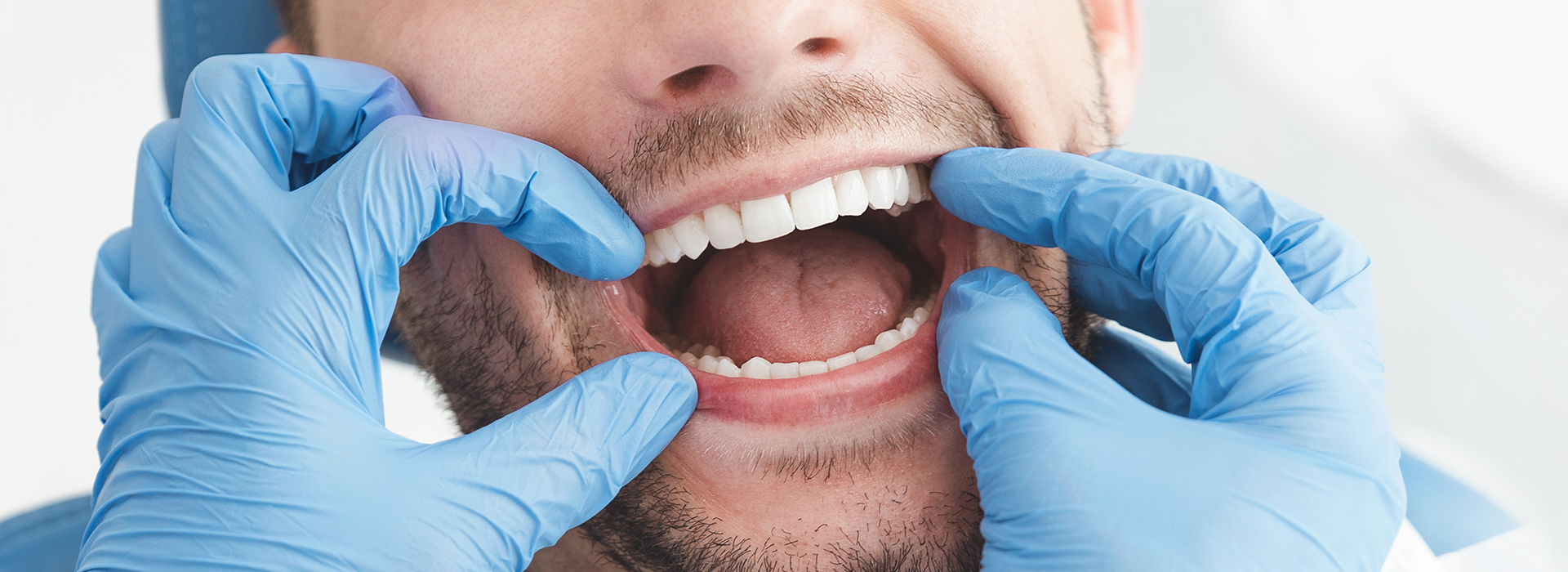 A man in a dental mask with his mouth open, showcasing a full set of teeth and blue gloves.