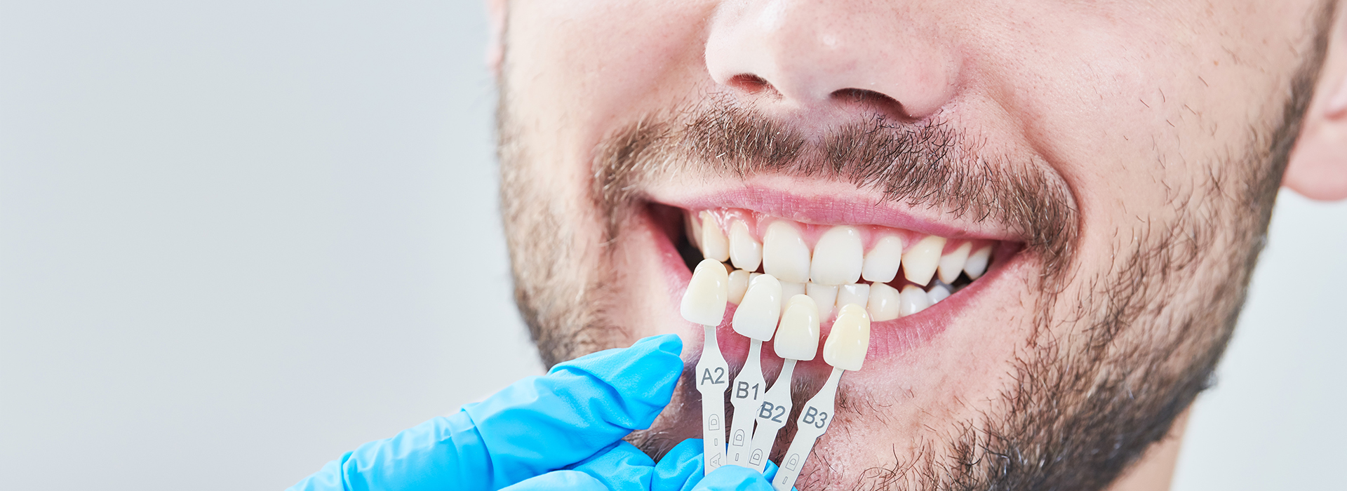 The image features a man with a toothy smile, wearing blue gloves and holding dental tools, likely in the process of dental work or demonstration.