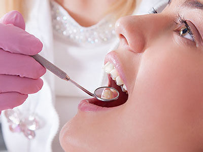 A dental professional is performing a teeth cleaning procedure on a patient s mouth, using specialized tools and equipment.